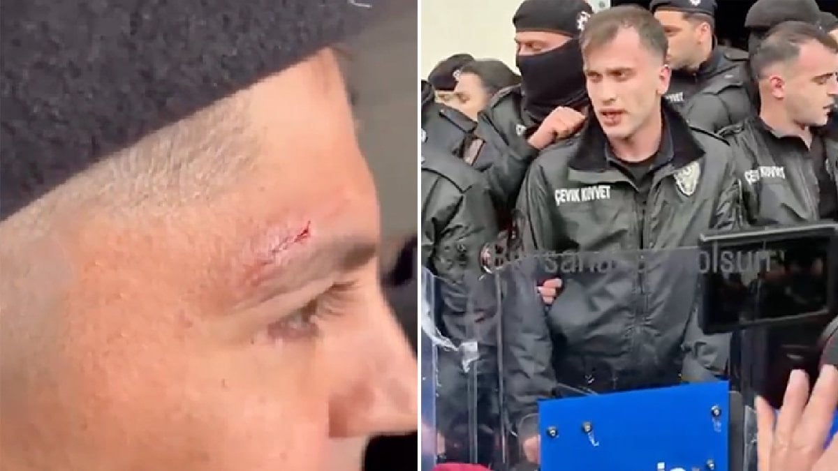 Bursa’da CHP’liler polise saldırdı: Bazı polisler yaralandı