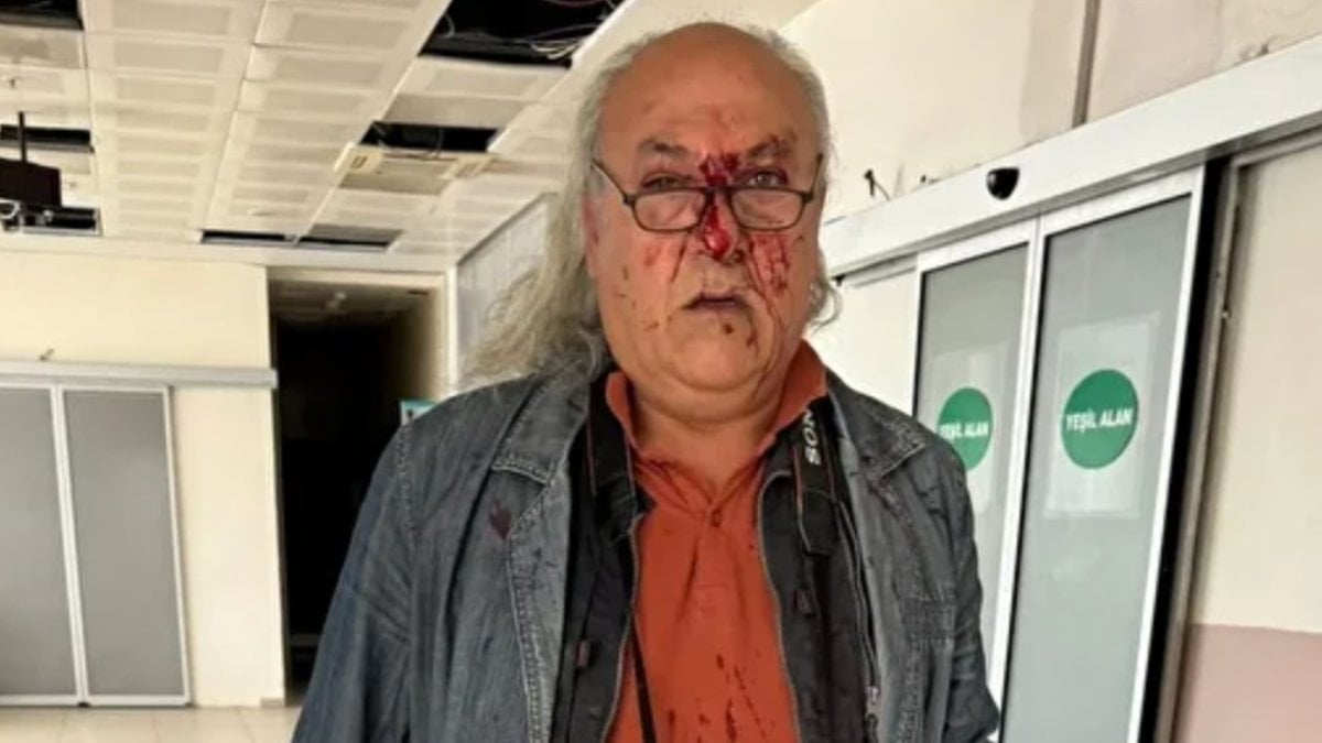 CHP’li Ayvalık Belediyesi’nin korumalarından gazeteci Yüksel Kalkan’a darp