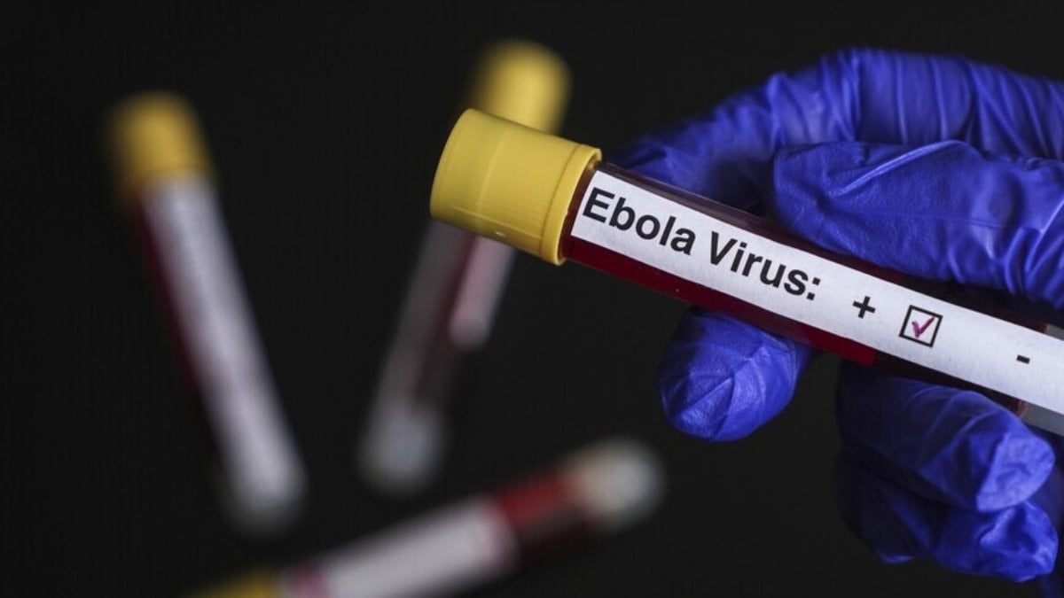 ABD’den Ebola uyarısı: Tarihin en ölümcül seviyesine ulaşabilir