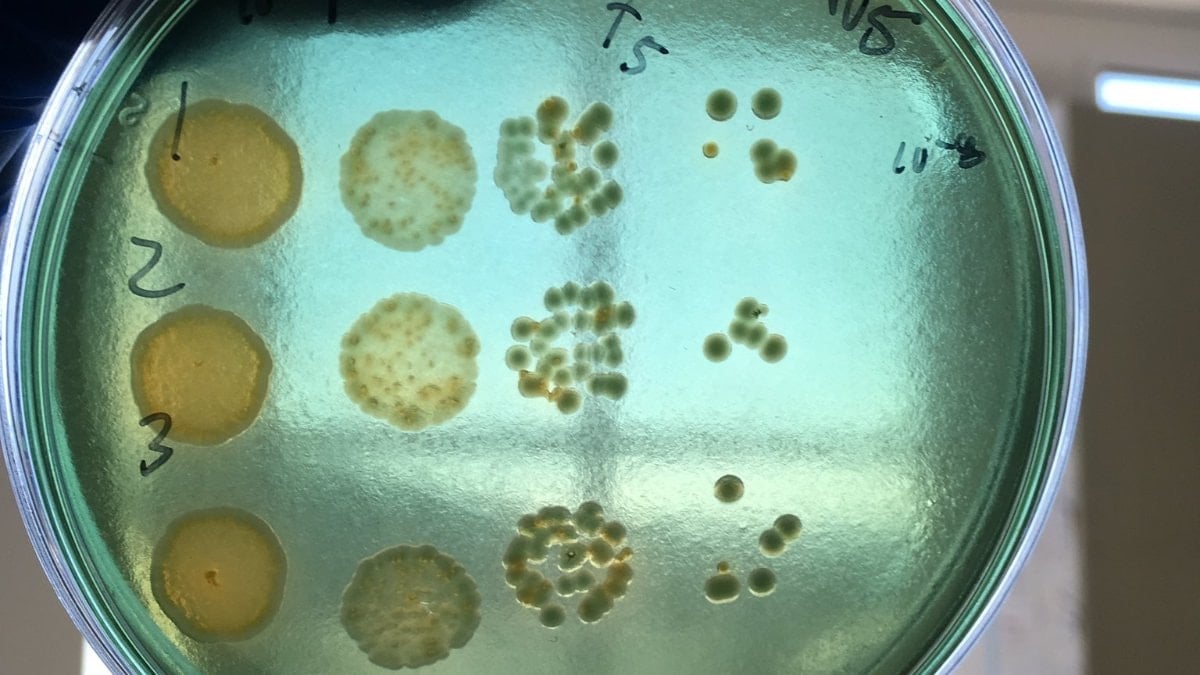 Et yiyen bakteriler yeni bir global salgın olma yolunda ilerliyor
