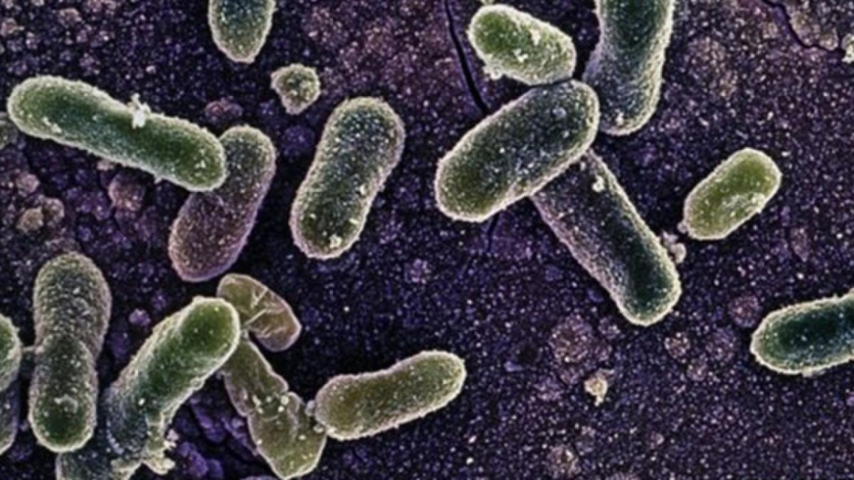 Belçika’da salmonella alarmı: En az 300 kişiye bulaştı
